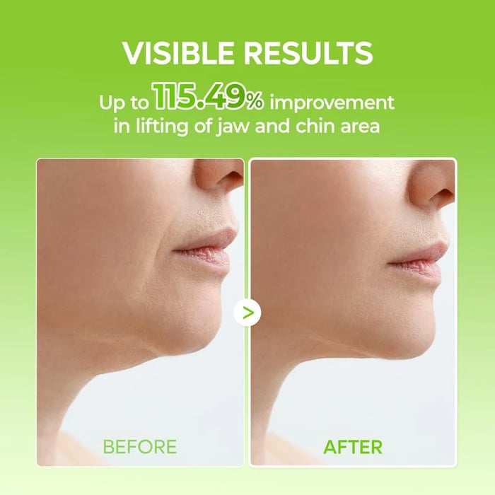 V-Lifting Mewing Band (4x Masks Per Pack)